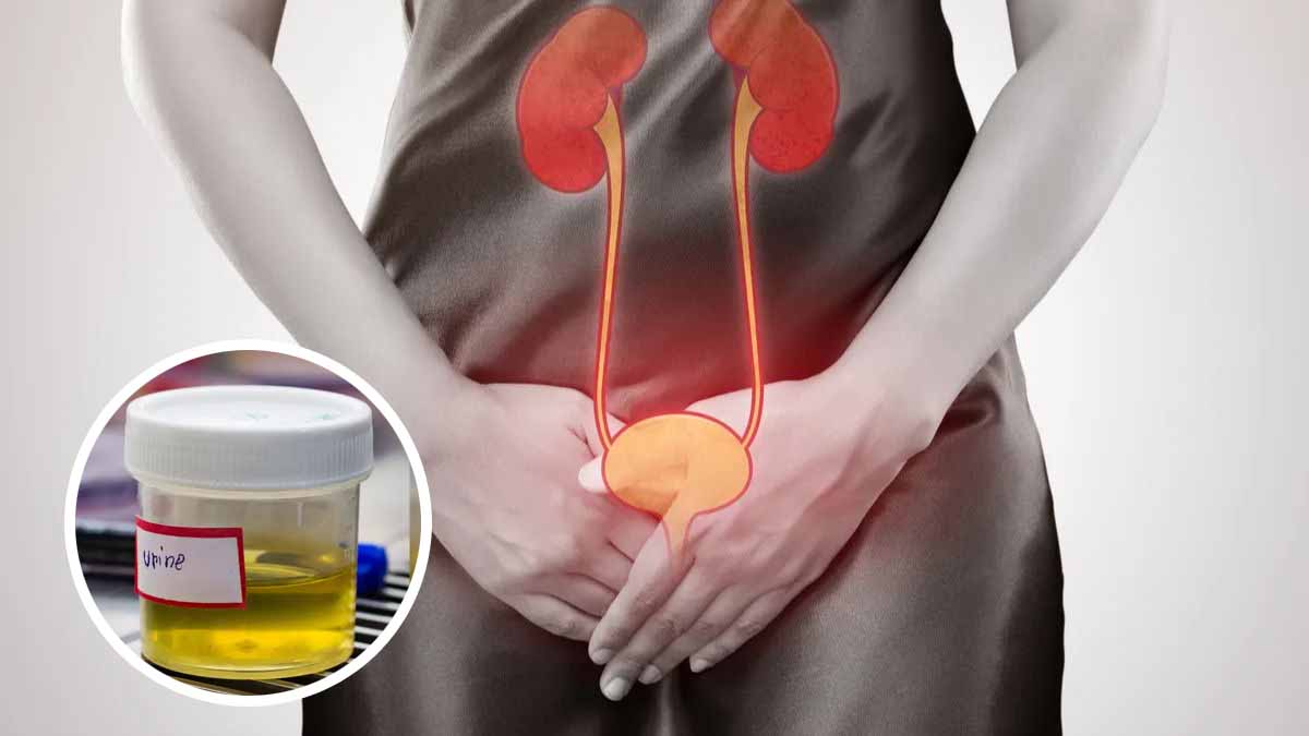 Health Tips For Urine